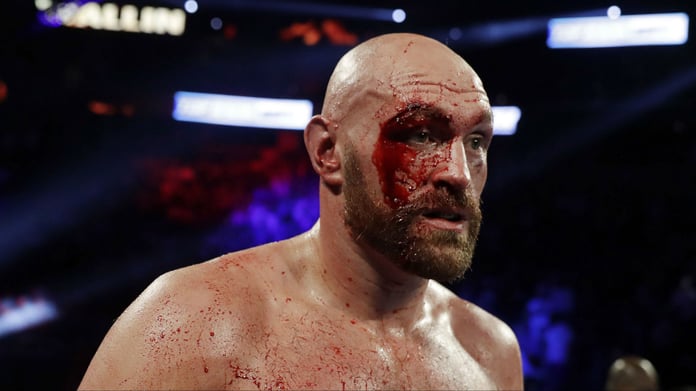 Tyson Fury Retains Favoritism For Deontay Wilder Re-match